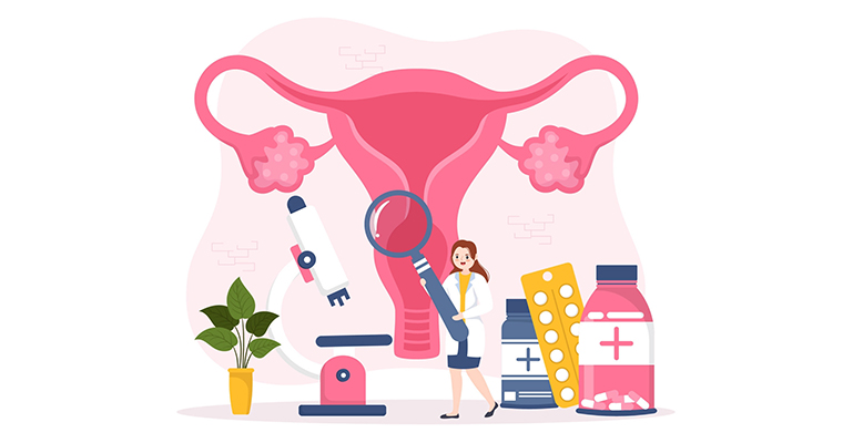 Gynae Oncology 